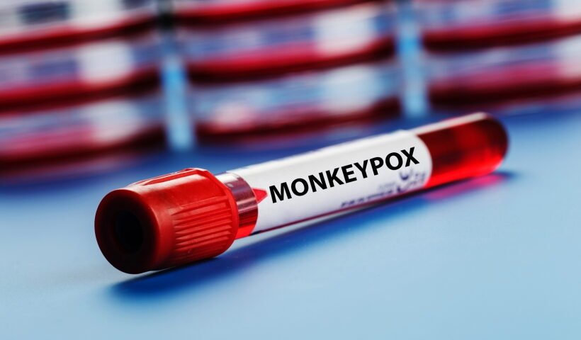 Monkeypox