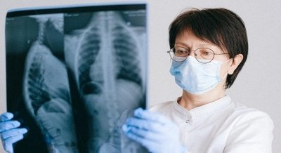 When Rheumatoid Arthritis affects your lungs