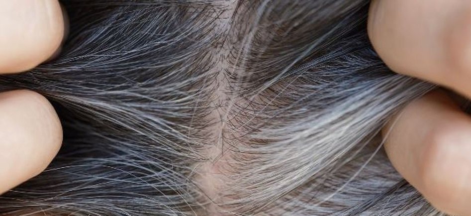 US scientists decode why our hairs turn grey