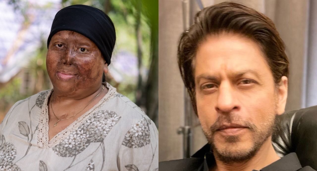 acid attack survivor reaches out for help to SRK